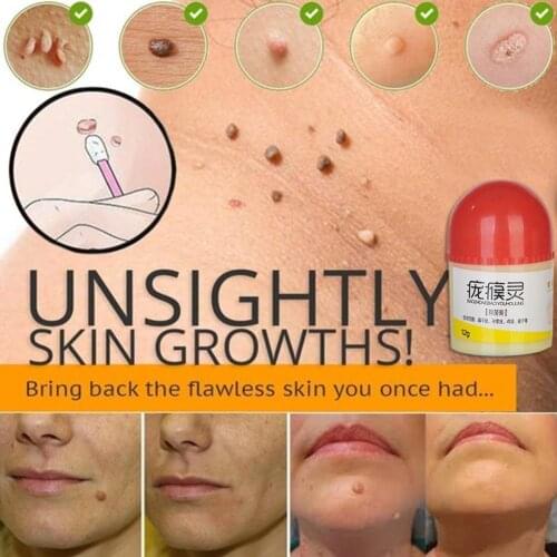 1PCS Skin beauty cream Skin Tag Remover 12 hours Tu Remover Medical Tag Skin Tu kill kill Mole V8O0