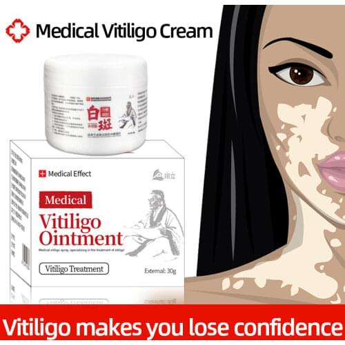 30g Vitiligo Treatment Ointment Psoriasis Localized White Spot Antibacterial Cream Leukoplakia Mycosis Treatment Care