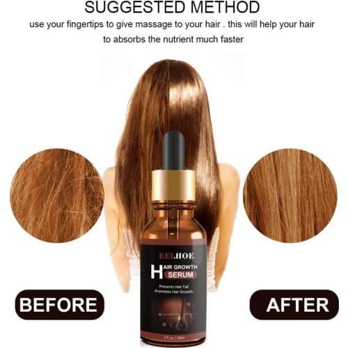 Prevent Hair Loss Product Hair Growth Essential Oil Easy To Carry Hair Care Nursing 3pcs 30ml Both Male And Female Can Use
