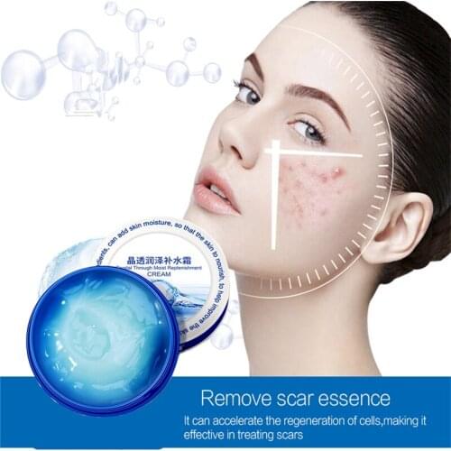 Acne treatment Hyaluronic Acid Face Black Pigmentation Whitening Serum Plant Skin Care Anti Aging Anti Wrinkle Nutrient Mask