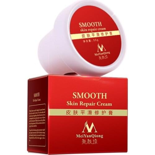 Body Cream stretch marks remover scar removal powerful postpartum obesity pregnancy body cream
