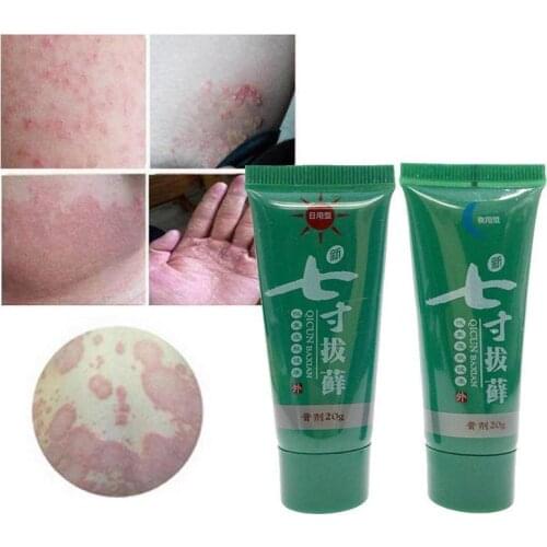1 Set Day & Night Body Psoriasis Cream Dermatitis Eczematoid Psoriasis Eczema Skin Ointment Treatment K9R2