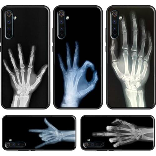 X-ray Hand Bones Case For OPPO Realme X50 Pro XT C3 6 7 X2 X7 Reno 4 Pro A9 For OnePlus 8 Pro 7 7T Nord