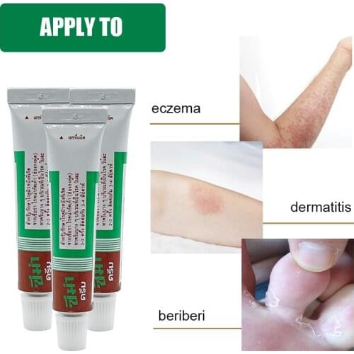 Thailand ZEMA Psoriasis Cream Herbal Anti-Bacterial For Anti-Itch Balm Treat Dermatitis Eczema Pruritus Fungal Infection