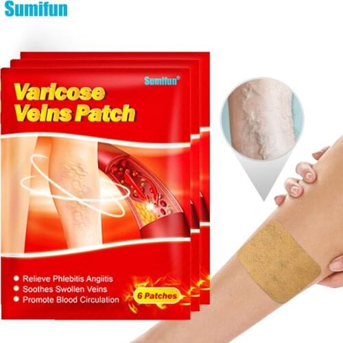 6/18/24/30pcs Varicose Veins Patches Leg Vasculitis Phlebitis Spider Anti-swelling Angiitis Removal Chinese Medical Plasters