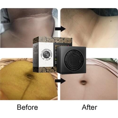 Women Private Vagina Whitening Soap Intimate Bamboo Charcoal 100g Skin Cleansing Anal Bleaching Cream For Dark Skin Body Care