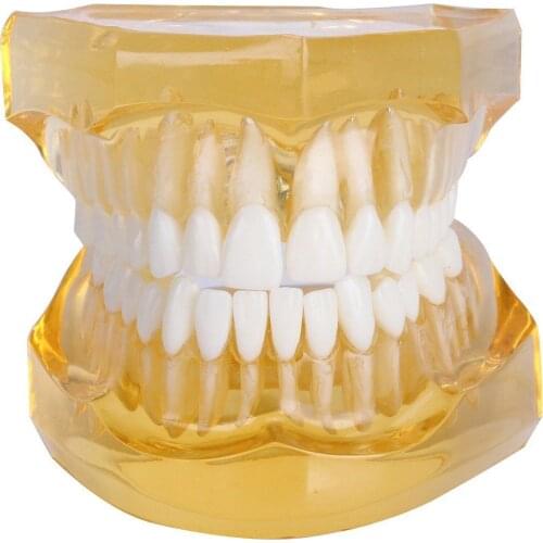 Dental Removable Teeth Model Adult Typodont Model for Dentist