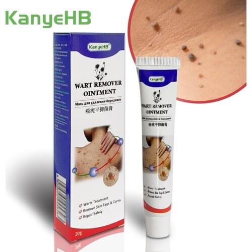 1PC Genital Wart Ointment Skin Tag Remover Cream Fast & Effective Remover All Foot Corn Papilloma Warts Moles Herbs Cream