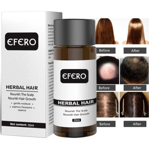EFERO 20ml Fast Powerful Hair Growth Oil Hair Loss Products Essential Oil Grow Restoration Growing Serum Hair Care