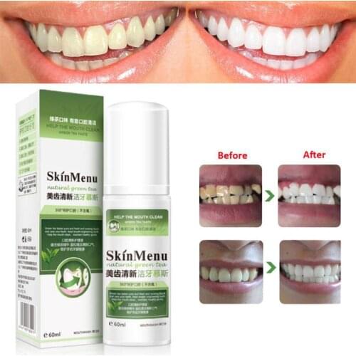 Oral Hygiene Teeth Cleaning Mousse Fresh Remove Oral Cleaning Foam Teeth Whitening Products Tooth Cream Oral Cleaning Care
