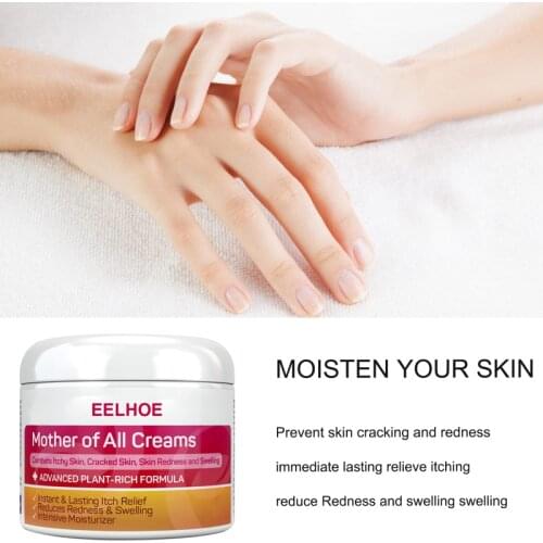 Skin Psoriasis Cream Dermatitis Eczematoid Eczema Ointment Treat Skin Care Cream Dropshipping