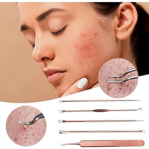 Acne Blackhead Remover Needles Kit Blackhead Extractor Tool Stainless Steel Pore Acne Black Spot Tweezers Box Set Beauty Tool