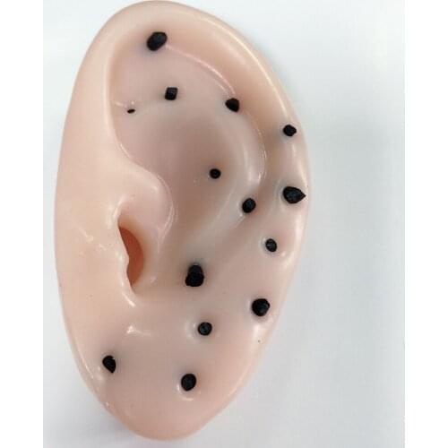 Funny Squeeze Acne Remover Stress Relief Toy For Adult and Kids