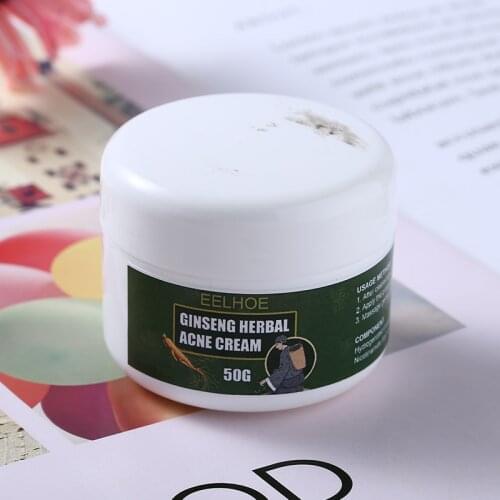 50g Anti-Acne Cream Acne Treatment Natural Ginseng Cream Treats inflammatory Pimple Blemishes Removal Decreasing Swelling