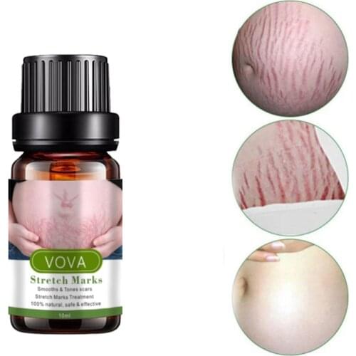VOVA Stretch Marks Remover Essential Oil Anti-Wrinkle Anti-Aging Fade Fine Lines Improve Skin Firmness Nourishing Skin Care 10ml