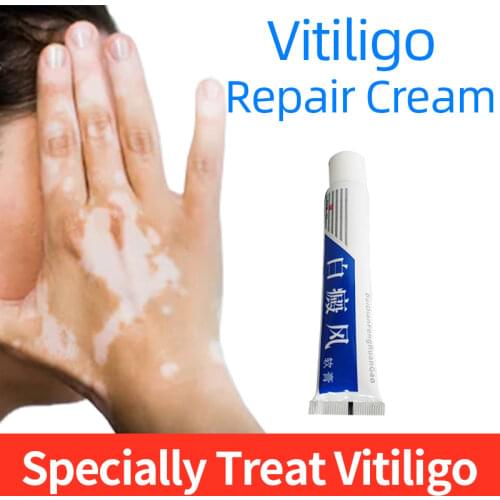 20g Chinese Medical Vitiligo Ointment Pigment Melanin Promoting Liniment Skin White Spot Leukoplakia Disease Treatment