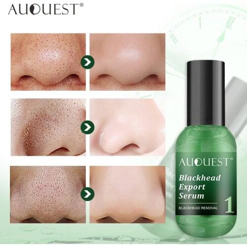 Blackhead Remover Serum Shrink Pore Acne Treatment Oil-Control Face Sheet Moisturizing Whitening Peeling Skin Care Cosmetic 15ml