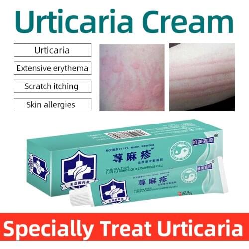 Acute and Chronic Urticaria Eczema Pruritus Cream Works For Measles/Diaper Rash/Red butts Herbal Medicine Dermatitis Ointment