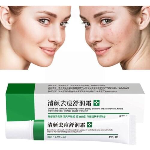 New Effective Acne Removal Acne Spots Oil Control Shrink Moisturizing Pores Beautiful Radiance Cream Acne Skin Whitening Sh F1J6