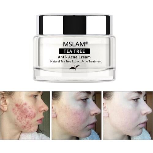 20g Tea Tree Cleansing Acne Cream Face Anti Acne Shrink Pores Deep Cleansing Oil-Control Facial Skin Moisturizing Cream