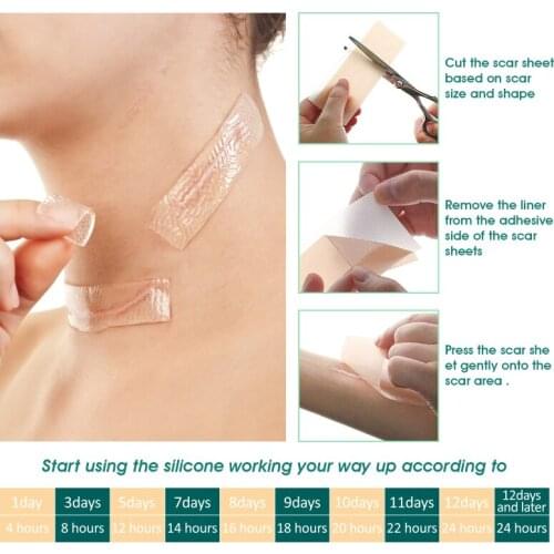 Efficient Surgery Scar Removal Silicone Sheet Therapy Patch for Acne Trauma Burn Scar Skin Repair Scar Burn Scar Reduce Hot