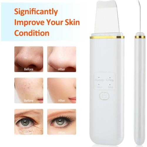 Ultrasonic Facial Skin Scrubber EMS Blackhead Acne Remover Pore Cleaner Face Cleaning Peeling Lifting Device Beauty Instrument