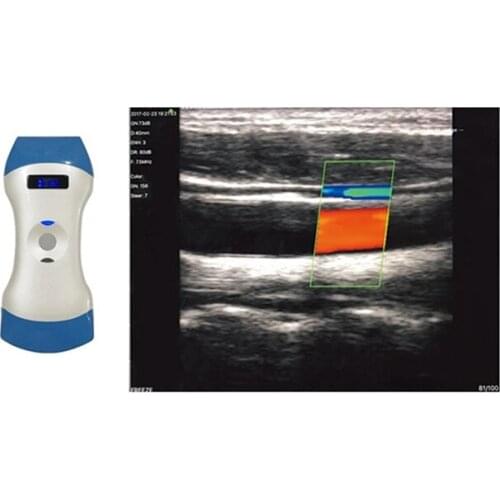Newest Mini Wifi 128 Elements Portable Double Head Color Doppler Wifi Ultrasound Three Probe Scanner