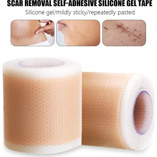 Efficient Beauty Scar Removal Silicone Gel Self-adhesive Silicone Gel Tape Patch For Acne Burn Scar Reduce