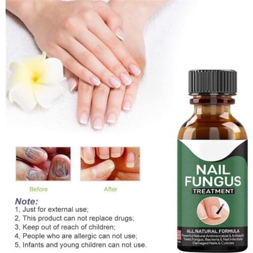 Fast Nail Fungal Treatments Nail Repair Essences Serum Care Treatments Foot Nail Fungus Removal Gel Paronychia Onychomycosis