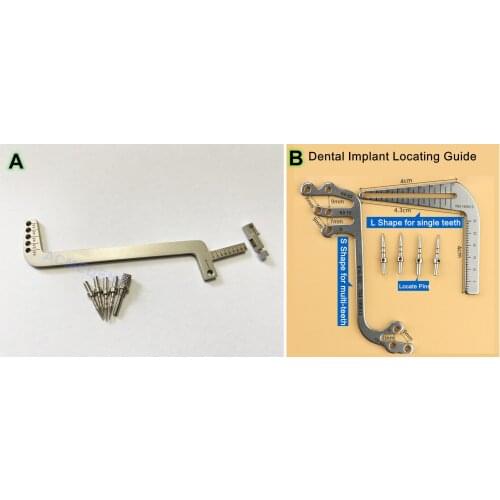 1Set Dental Guide Appliance Guidence Implant Locator Pins Gauge Ruler Locating Sliding Caliper S-Shape 2021NEW Multiple Teeth