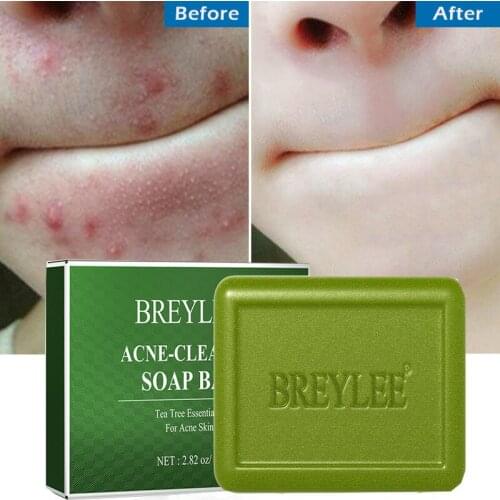 BREYLEE Facial Cleansing Soaps China