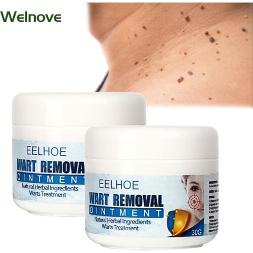 30g Skin Tag Remover Cream Herbal Extract Foot Corn Warts Ointment Warts Remover Antibacterial Ointment Wart Treatment Cream