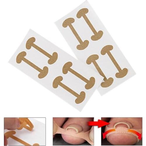 4 stickers/set Ingrown Toe foot Nail Correction Fixer Nail Pedicure Tool quick pedicure Toe nail Corrector Protect Toenails