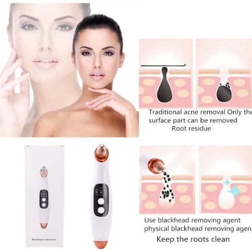Facial Acne Blackheads Remover Pore Cleaner Vacuum Cleaner Microcry stalline Blackhead Vacuum Cleaner Deep Cleansing