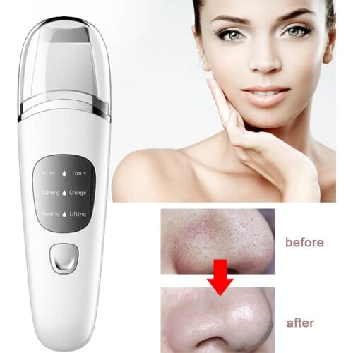 Ultrasonic Facial Skin Scrubber High-frequency Vibration Face Spatula Cleaning Remove Pore Dirt Blackhead Peeling Lifting Tool