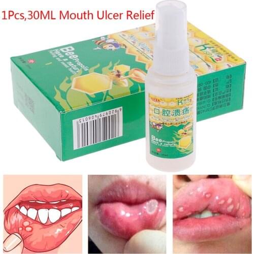 1PCS 30ml Propolis Mouth Clean Oral Spray Treatment Of Oral Ulcer Pharyngitis Halitosis Sore throat cool Fresh Spray