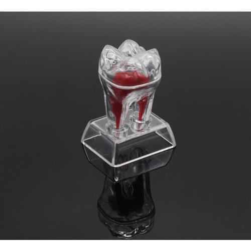 Separable Dental Lab Teeth Molar Model Teaching Demonstration Model Transparent