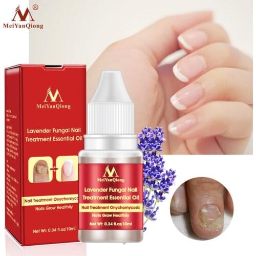 Herbal Fungal Nail Treatment Serum Onychomycosis Paronychia Anti-Fungal Nail Infection Toe Fungus Foot Repair Essence Nails Care