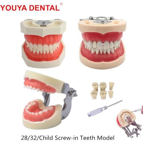 Resin Dental Standard Model With Removable Teeth For Training Screw-in Tooth Model Dentistry Dentist Teaching Practice Demo Tool