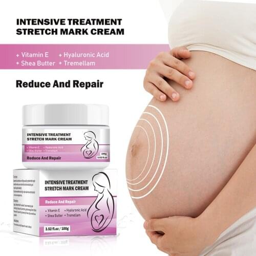 100g Stretch Mark Repair Cream Neutral Spot Moisturizing Repair Reduce Fine Lines Stretch Mark Cream for Pregnant Women