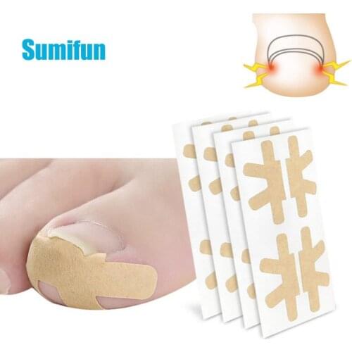 4pcs Professional Embedded Toe Nail Corrector Sticker Ingrown Toenail Care Pedicure Thumb Curl Correction Pastes Nail Care