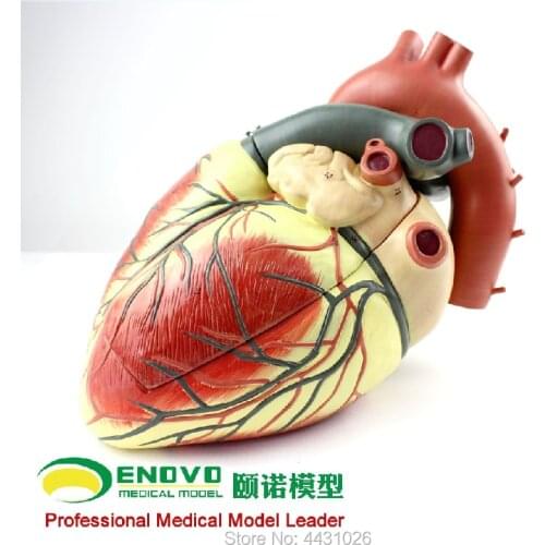 ENOVO Medical ultrasound human heart model cardiology ultrasound ultrasound model of cardiac cardiovascular anatomy