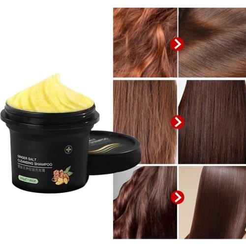 FGHGF Anti-dandruff Shampoos