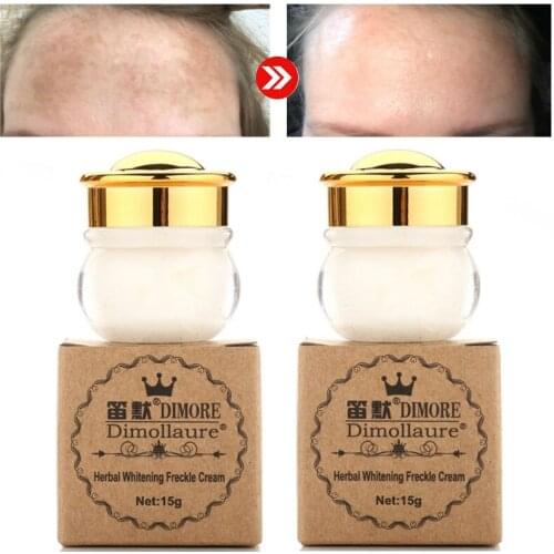 Dimollaure whitening freckle face cream Removal melasma Freckle speckle sunburn Spots pigment Melanin scar skin whitening cream
