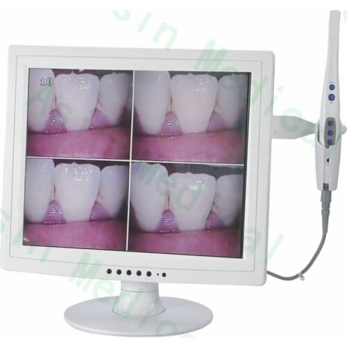 Dental Intra oral Camera M-958A+CF-687 15 Inch Digital LCD AIO Monitor+WI-FI Asin
