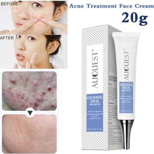 New Cleaning Acne Skin Antibacterial Acne Healing Cream Gel Scar Removal Skin Repair Cream Comedone Pimple Blackhead Treatment