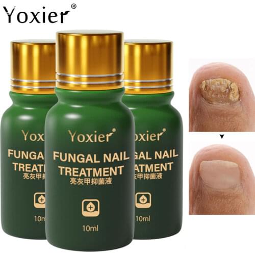 Yoxier Fungal Nail Treatment Repair Thickening Atrophy Yellowing Shedding Nourish Anti Infection Herbal Formula Nail Care 3Pcs