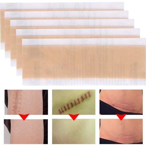 Silicone Removal Patch Reusable Acne Gel Scar Therapy Caesarean Section Trauma Burn Sheet Cover Skin Repair Efficient Surgery
