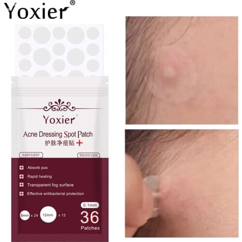 Yoxier 36pcs Ance Pimple Patch Skin Care Waterproof Ance Treatment Stickers Face Mask Remover Tool Blemish Spot Face Cream