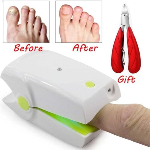 Painless Nail Fungus Cold Laser Treatment Device Nail Fungus Removal Foot Care Nail Cleaning Device No Side Effects Safety